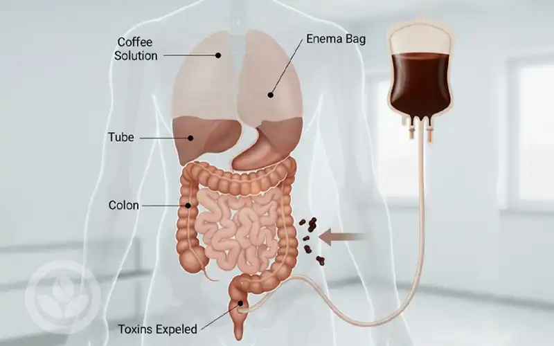 Thải Độc Đại Tràng Bằng Cà Phê Rang Xay Nguyên Chất Cùng VNO COFFEE BEAN